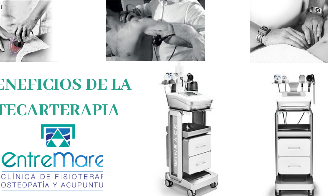 BENEFICIOS DE LA TECARTERAPIA