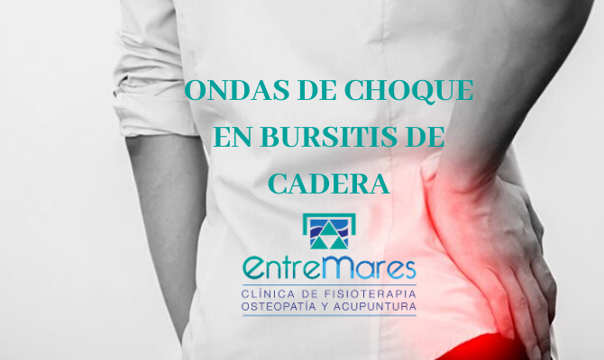 ONDAS DE CHOQUE EN BURSITIS DE CADERA