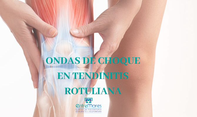 ONDAS DE CHOQUE EN TENDINITIS ROTULIANA