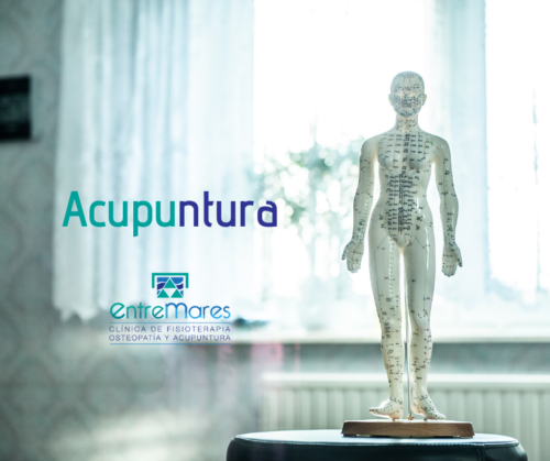 acupuntura torrevieja