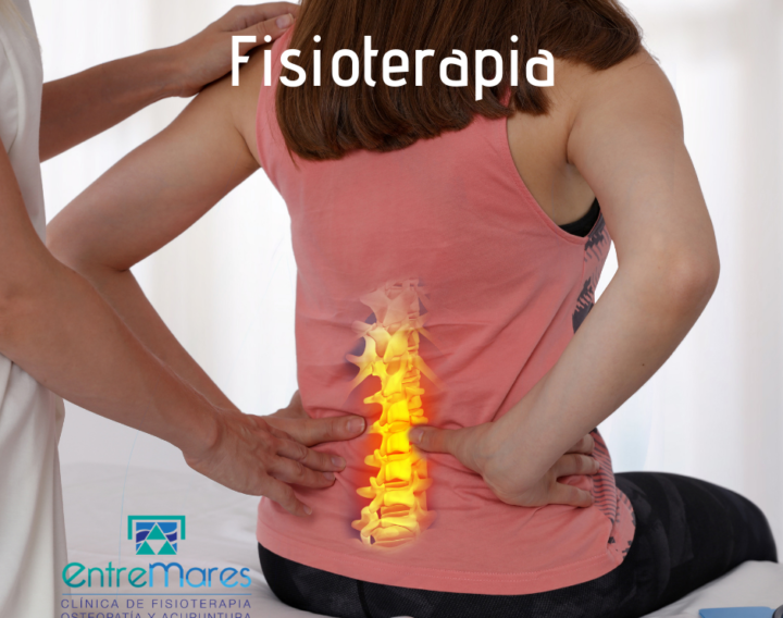 fisioterapia torrevieja